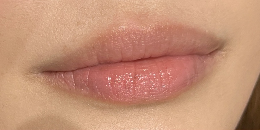 フルリップ Before