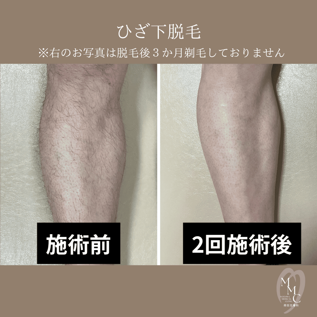 casephoto