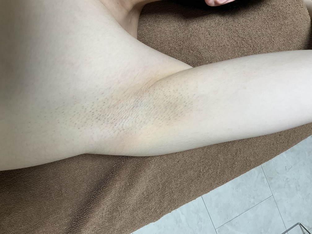 casephoto