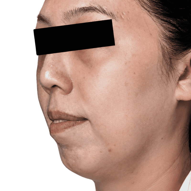 casephoto