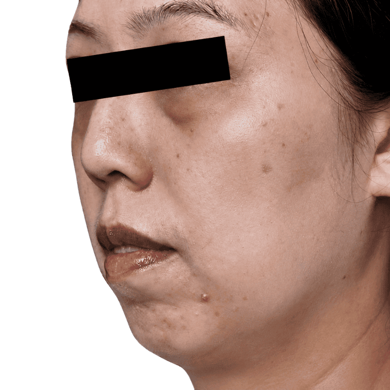 casephoto
