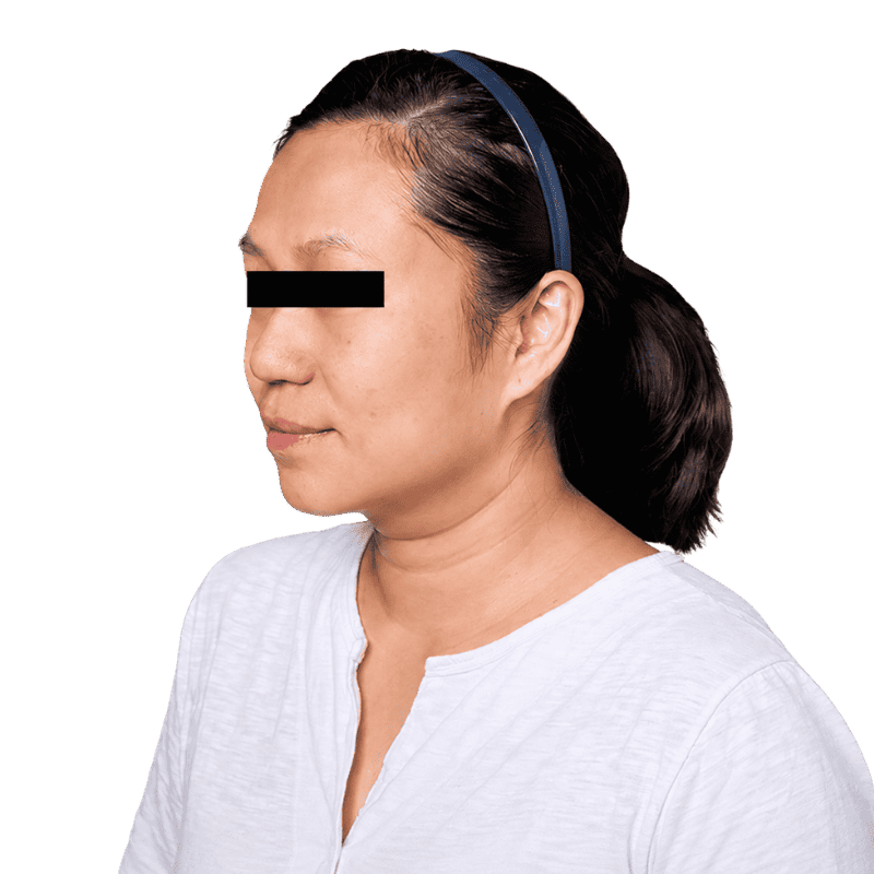 casephoto