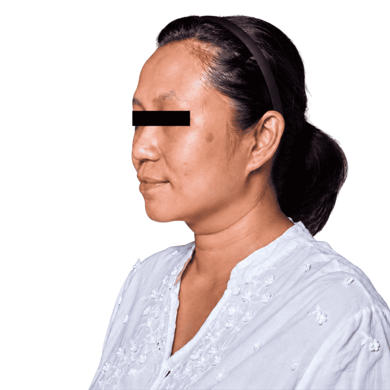 casephoto