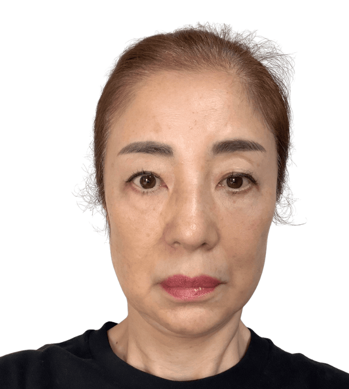 ぽにょりん 1週間後