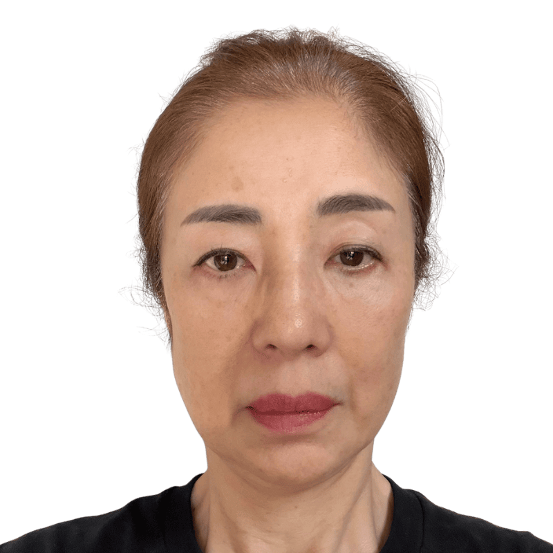 ぽにょりん 2週間後