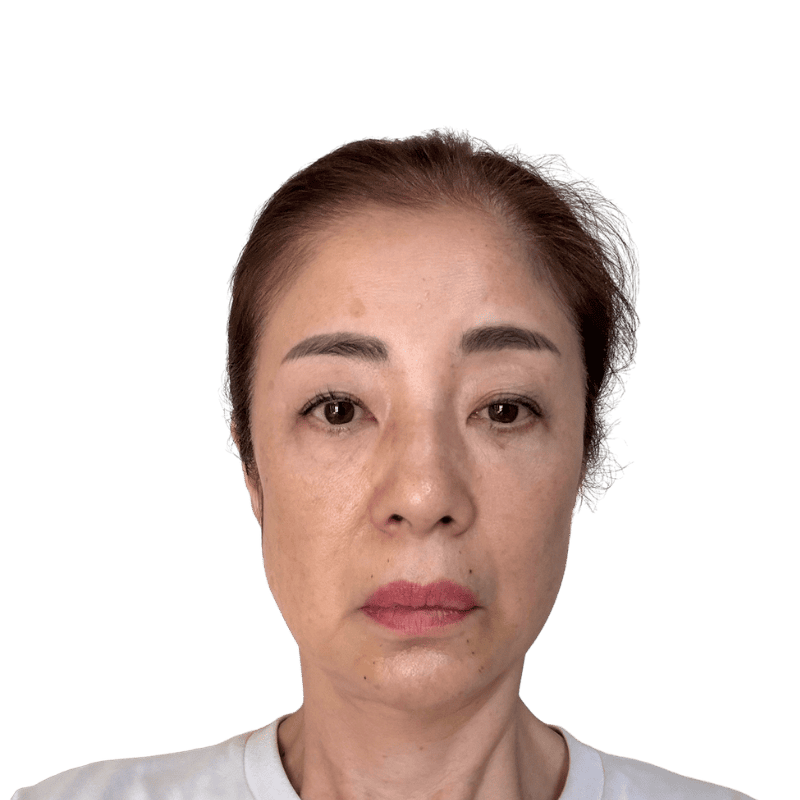 ぽにょりん 3日後