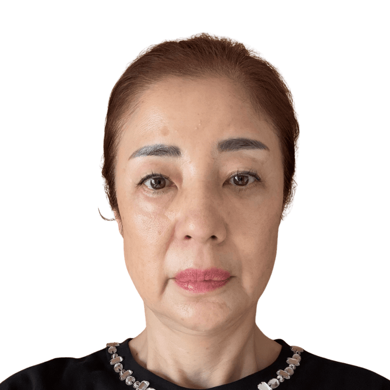 ぽにょりん 施術前